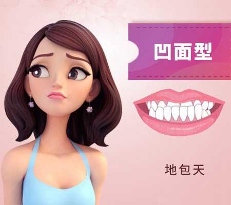 什么是地包天？地包天長什么樣子？地包天牙齒圖片