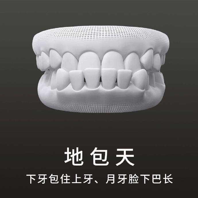 什么是地包天？地包天長什么樣子？地包天牙齒圖片
